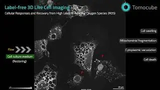 Cancer cells' response to reactive oxygen species, taken label-free by Holotomography system