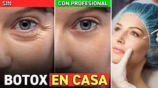 &iexcl;Haz BOTOX EN CASA! &iexcl;R&aacute;pido y Econ&oacute;mico! &iexcl;Rejuvenece tu rostro!
