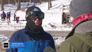 Good Question: Why do our noses run in cold weather?