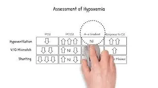 Ventilation to Perfusion Mismatch and Assessment of Hypoxemia!