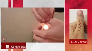 Master Tung's Acupuncture Point: 11.26 Zhi Wu【制污】Acupuncture Point
