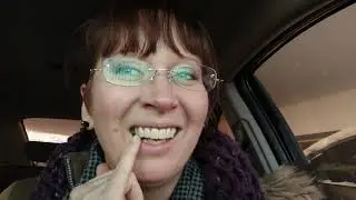 My dental bridge journey - part 9 - final cement