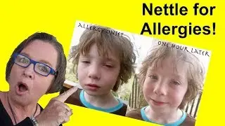✅ Nettle for Allergies: A Simple Nettle Tea Remedy for Allergies