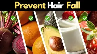 Top 10 foods to prevent hair fall