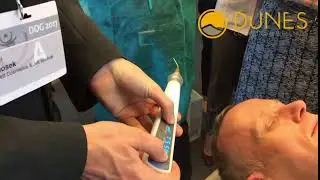 Calibrer le Jett Plasma Lift M&eacute;dical