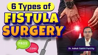 Discover the 6 types of fistula surgery treatments 🏥, their advantages ✅ and disadvantages ❌