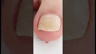 Оригинальный Микозофаг, артикул 67774905. Проверено тысячами.