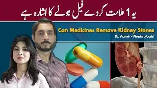 Can Medicines Remove Kidney Stones | Is Kidney Transplant Mehfooz Hota Hai