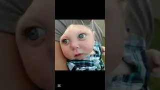 Люди без частей тела....😳 #шорты #вирусный #тренд #tiktok