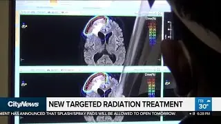 New targeted radiation treatment for cancer patients