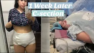 1 week postpartum c-section recovery 2021 | day in the life with newborn baby 2021
