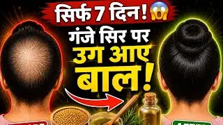 hair fall solution at home #baldness #hair fall and hair growth treatment at home 
