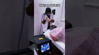 Carbon Laser Peel Also known as Hollywood Facial 🎬✔Instant glow, Improves pigmentation#reels