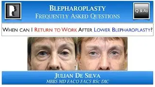 Lower Blepharoplasty Recovery: Returning to Work after Lower Eyelid Surgery