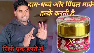 Extra White Face Cream Review | Does it really make you fair or a hoax? #skin #skinglow