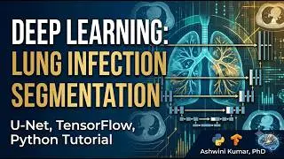 Deep Learning for Medical Image Segmentation: U-Net Tutorial & Hands-On Implementation