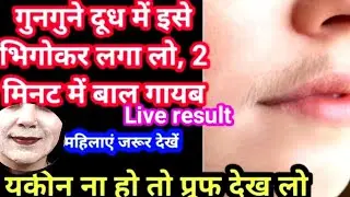 Stop Shaving👉ये मामूली सी चीज दाढ़ी,मूछ को ऐसे साफ किया😱हैरान हूं । facialhairremoval at home