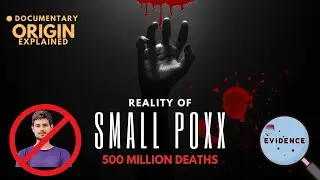 Smallpox | Red plague | Treatment | Origin | First vaccine | Dhruv Rathee | Deadly virus | Mr Eshban