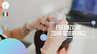 🇮🇹 L’estrazione della zona donatrice, la parte più delicata