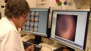 Voorkom blindheid bij te vroeg geboren baby's