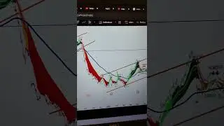 Best stock to buy today 17/10/2025 | DMART STOCK PREDICTION #nifty #dmart #stocks