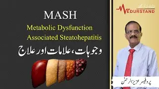 Urdu: MASH | Metabolic Dysfunction-Associated Steatohepatitis | Medurstand by Prof Aziz ur Rehman