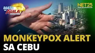 Monkeypox task force inilunsad sa Cebu; face mask, di epektibo ayon sa DOH