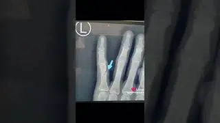 переходить на мой лайк пожалуйста