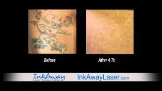 Real Clients... Real Results... Call InkAway Today for a Free Consultation