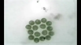 Colony of Ciliates