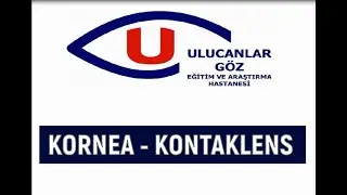 Ulucanlar Göz E.A.H - Kontaklens