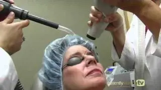 Non-invasive Wrinkle Removal Procedures - ActiveFX