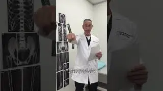 How to avoid shoulder surgery-we asked Dr. Brooks to share the biggest mistake his patients make