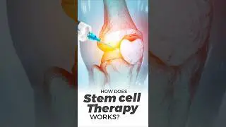 How Stem Cell Therapy Works #shorts