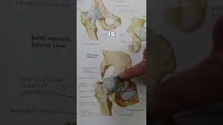 Hip Labrum Anatomy