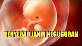 Ibu Hamil Waspada, Inilah Hal yang Meningkatkan Resiko Janin Keguguran