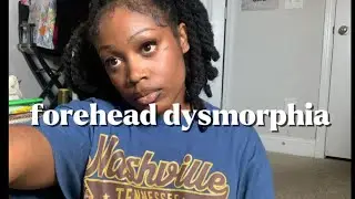wigs causing forehead dysmorphia & actually making u look uglier 