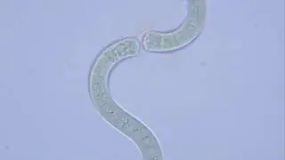 Spirulina / Arthrospira platensis 1000 magnification