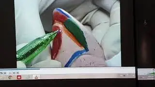 TP Prothèse fixée - préparation 3/4 ( PART 1/2)