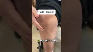 Falling After Total Knee Replacement