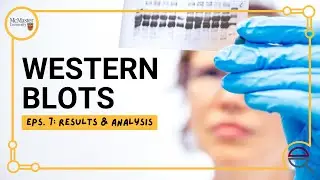 Western Blot: Result Interpretation