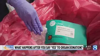 What happens after you say 'yes' to organ donation?