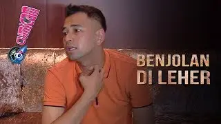Ada Benjolan di Leher, Raffi Ahmad Disarankan Istirahat Total - Cumicam 01 Juli 2019