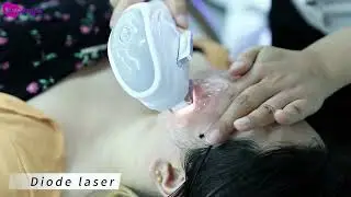 Multi-Function Laser Machine: Nd:YAG + Diode for Clinics & Salons