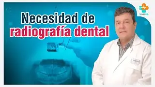 Necesidad de Radiograf&iacute;a Dental | Tu Salud Gu&iacute;a