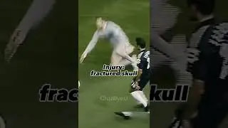 The worst injuries I&rsquo;ve ever seen PT2#footballsoccer