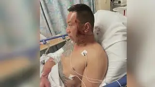 Man viciously attacked by stranger in Chinatown