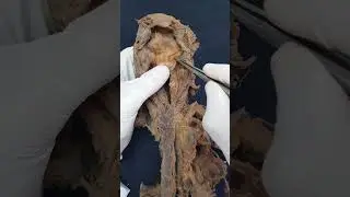 LARINGE (PARTE 7) - Anatomia humana #Shorts #medicina #anatomia #aula #anatomy #biologia