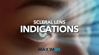 Fitting Maxim 3D Scleral Lenses: Indications & Advantages