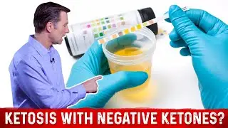 Can You Be in Ketosis Despite No Ketones in the Urine? &ndash; Dr. Berg